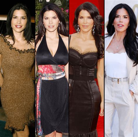 lauren sanchez surgery|Lauren Sanchez Plastic Surgery: Before and After ...